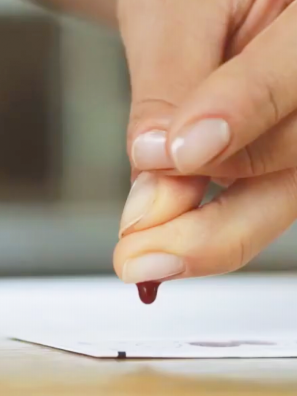 dry blood spot test